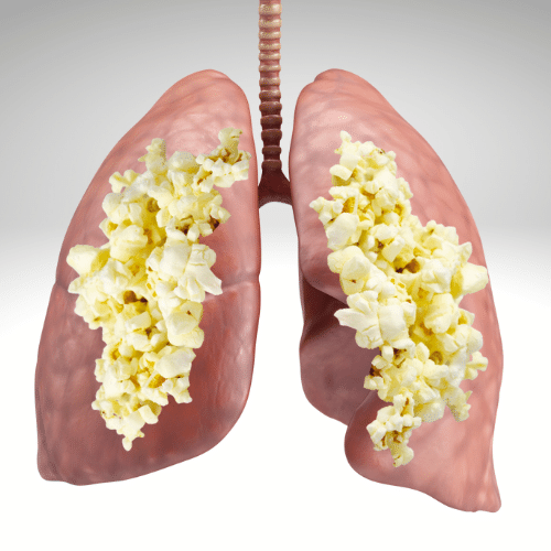 Popcorn lung vaping - Vaperite - Vape